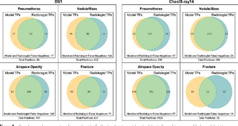 Figure 4 From Chest Radiograph Interpretation With Deep Learning Models