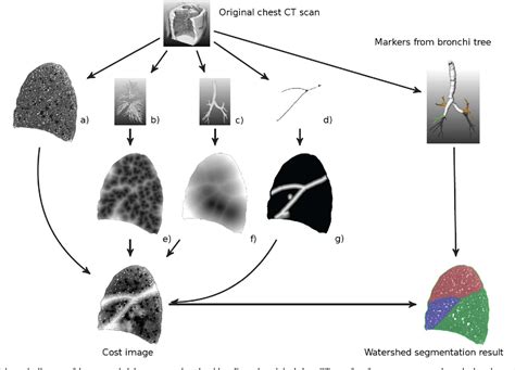 Figure 11 From Automatic Segmentation Of The Pulmonary Lobes From Chest Ct Scans Based On