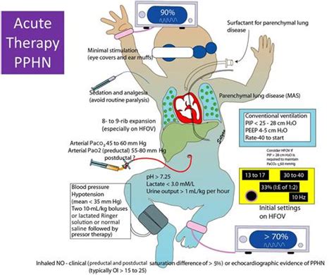 Persistent Pulmonary Hypertension Of The Newborn Neoreviews