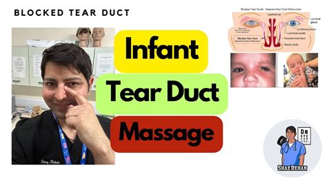 Tear Duct Massage Crigler For Infants For Blocked Tear Duct Crigler