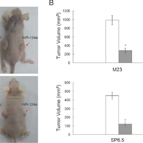 Introduction Of Mir A In Uveal Melanoma Cells Suppresses Tumor