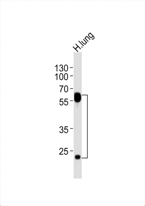 FLT1 Antibody Purified Mouse Monoclonal Antibody Mab WB E Buy Now