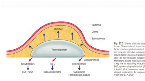 Properties Visco Elastic Of Skin Principles In Skin Expansion Youtube