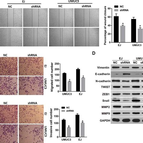 Dnmt B Knockdown Inhibits Migration Invasion And Emt In Bladder