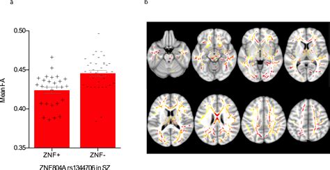 Genome Wide Discovered Psychosis Risk Gene Znf804a Impacts On White