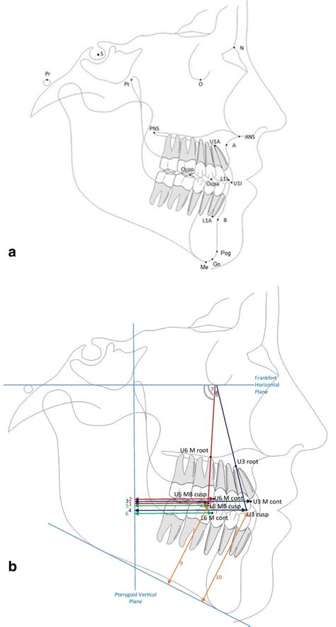 A Cephalometric Landmarks B Cephalometric Analysis According To Download Scientific Diagram