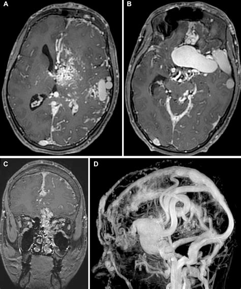 Case 314 Radiology