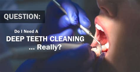 Deep Teeth Cleaning vs Routine Cleaning - Larry Saylor D.M.D.