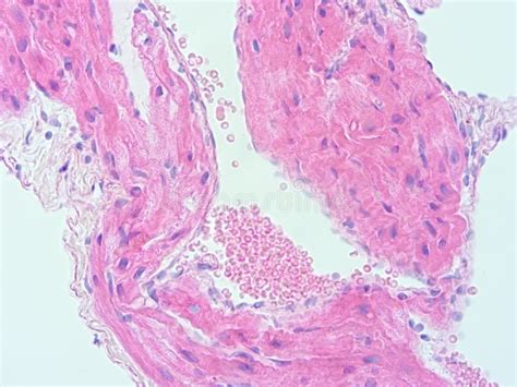 Histologie De Tissu D Humain De Coeur Image Stock Image Du Biologie