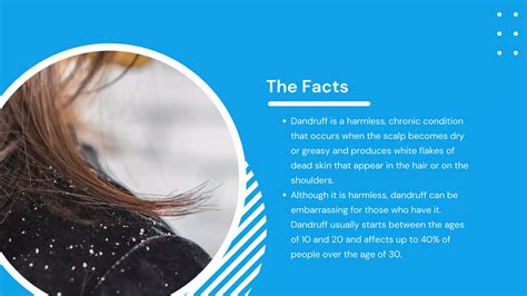 Facts And Causes Of Dandruff Hair Ensure Ppt