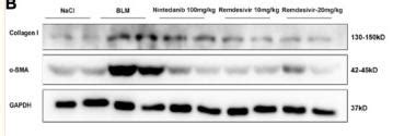 Collagen I Antibody Affinity Biosciences