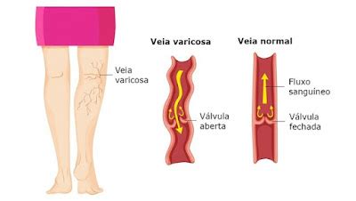 Sistema Cardiovascular Biologia A Ci Ncia Da Vida