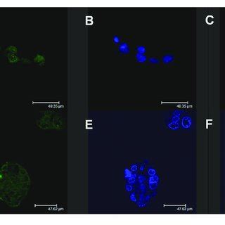 Confocal Laser Scanning Microscopy Micrographs Of Caco Cells