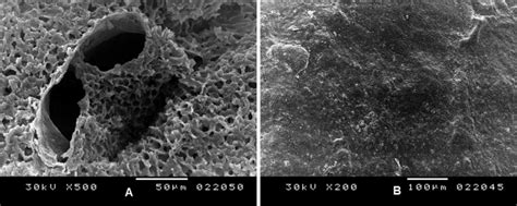 Scanning Electron Microscopic Examination Of Decellularized Specimens