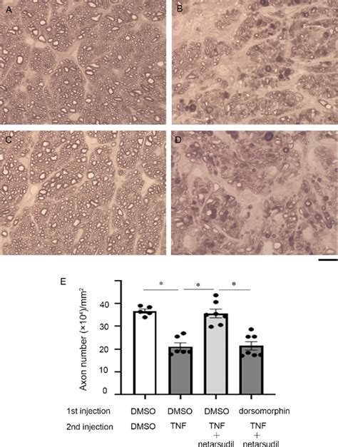 Axonal Protection By Netarsudil A Rock Inhibitor Is Linked To An Ampk