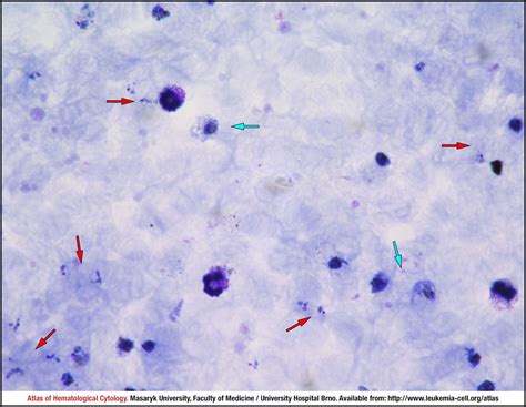 Plasmodium Vivax Images