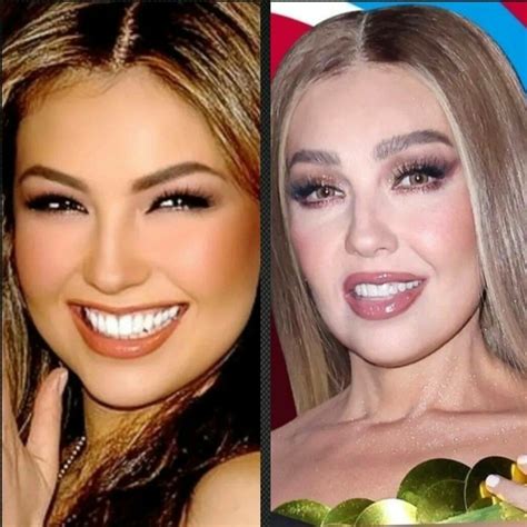 Thalia Antes Y Despues