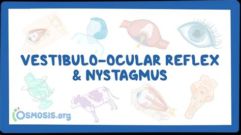 Vestibular Ocular Reflex Pathway