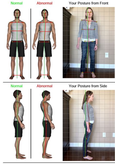 Postural Correction Speciality Imperial Health