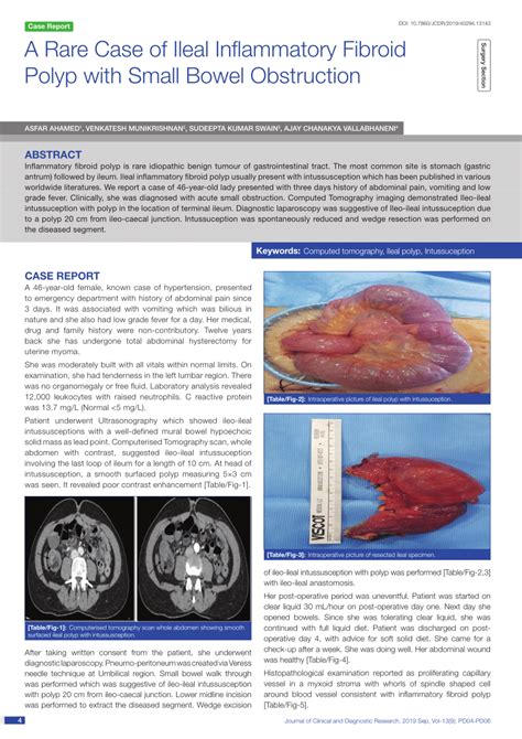 PDF A Rare Case Of Ileal Inflammatory Fibroid Polyp With Small Bowel