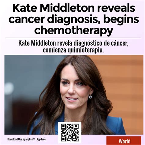 Kate Middleton reveals cancer diagnosis, begins chemotherapy – SPANGLISH.CA