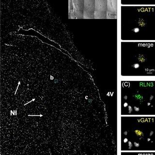 In Situ Hybridization RNAscope Detection Of RLN3 MRNA In The Coronal