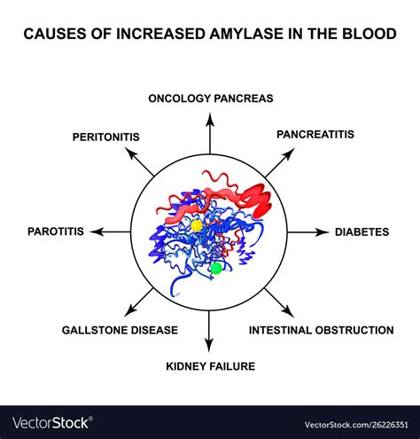 Causes increased amylase in blood Royalty Free Vector Image