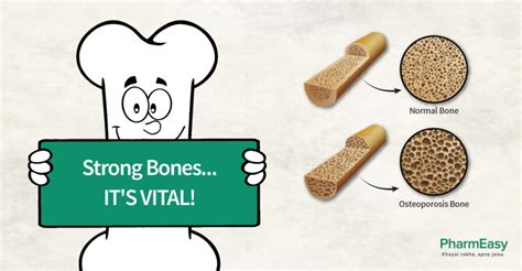 How To Keep Bones And Joints Healthy