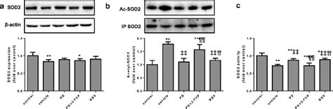 Expression Of SOD2 Protein Acetylation Level And Activity In The