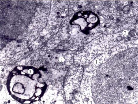 Cytoplasmic Vacuolization Of A Supporting Epitheliocyte 1