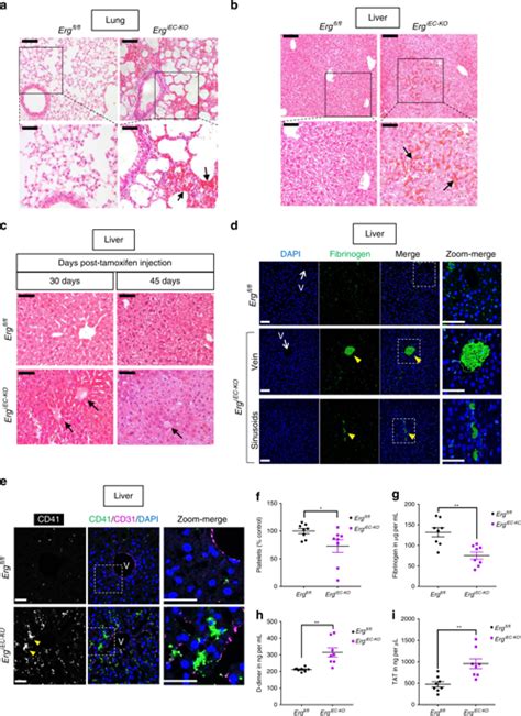 The Transcription Factor Erg Regulates A Low Shear Stress Induced Anti