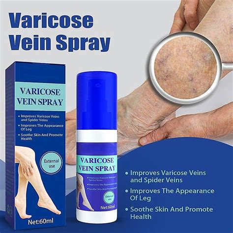 Spray Pour Varices Spray De Traitement Des Varices Pour Les Jambes