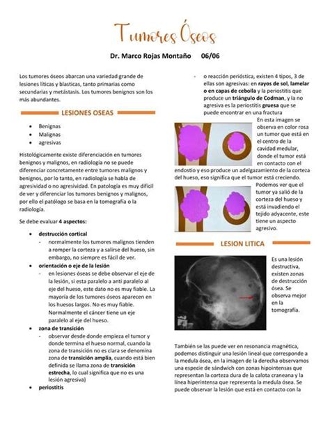 Tumores Oseos Parte Radiologia Teoricas Umss Jeffrey Ariel Loayza