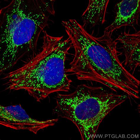 Hsp60 Antibody 15282 1 Ap Proteintech