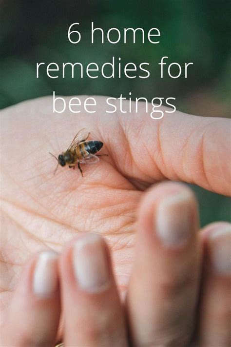 6 Home Remedies For Bee Stings Remedies For Bee Stings Bee Sting