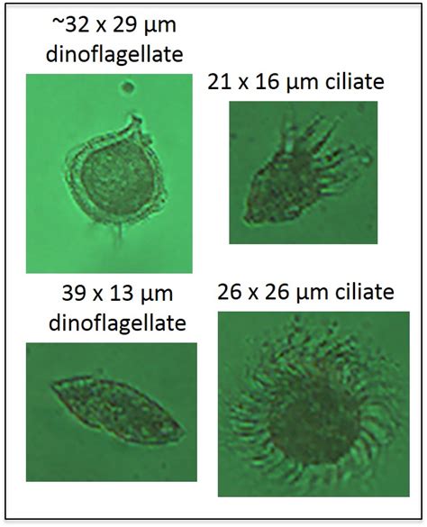 Dinoflagellates Microscope