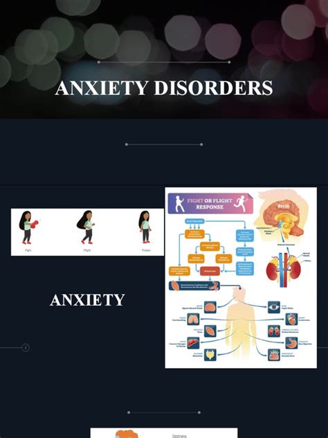 Overview - Anxiety Disorder | PDF | Generalized Anxiety Disorder | Anxiety Disorder