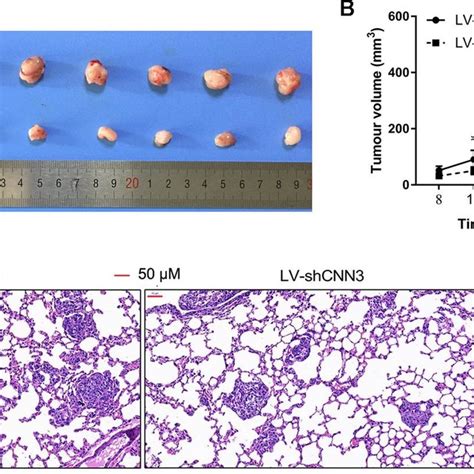 CNN3 Silencing Inhibits Tumor Growth And Lung Metastasis In Vivo A