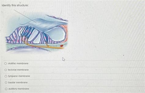 [Solved]: Identify this structure: otolithic membrane tecto