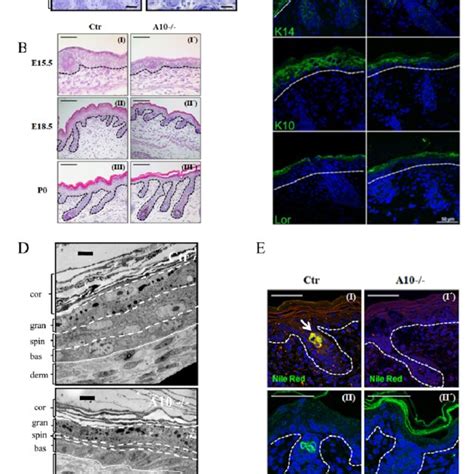 Histological And Ultrastructural Analysis Of Newborn Adam Deficient