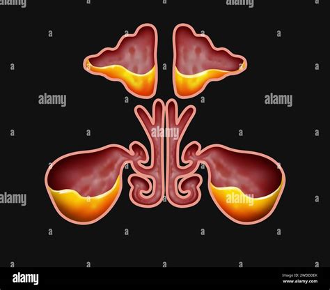 Frontal Sinus Cavity Hi Res Stock Photography And Images Alamy