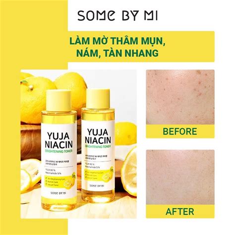 Some By Mi Nước Hoa Hồng Dưỡng Sáng Mờ Thâm Nám Yuja Niacin 30 Days