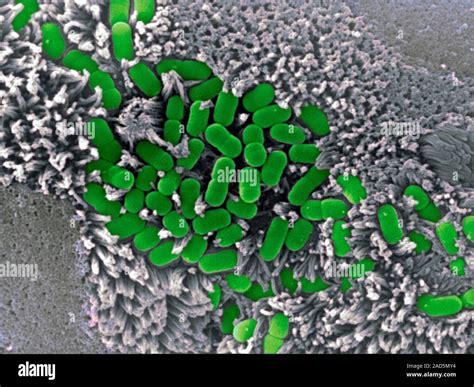 Epec Bacteria On Small Intestine Tissue Coloured Scanning Electron Micrograph Sem Of