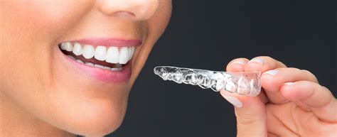 Suresmile Clear Aligner Braces — Adobe Dental Design of Sedona Dentists