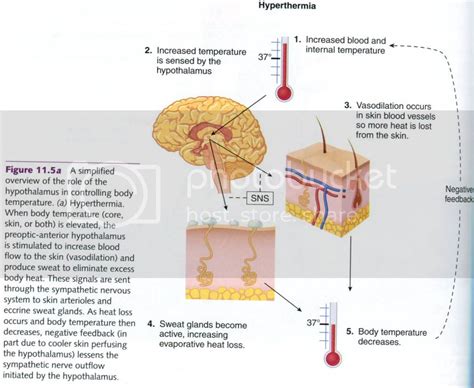 Body Temperature Regulation; Heat Loss; Thermoregulation