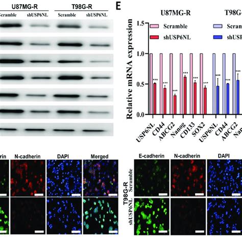 USP6NL Inhibition Regulates Cancer Stemness Properties Of GBM Cells