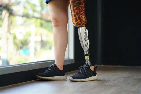 Prosthetic Leg Stock Photos, Images and Backgrounds for Free Download