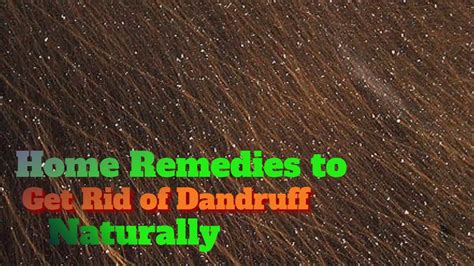 Home Remedies To Get Rid Of Dandruff Naturally Youtube