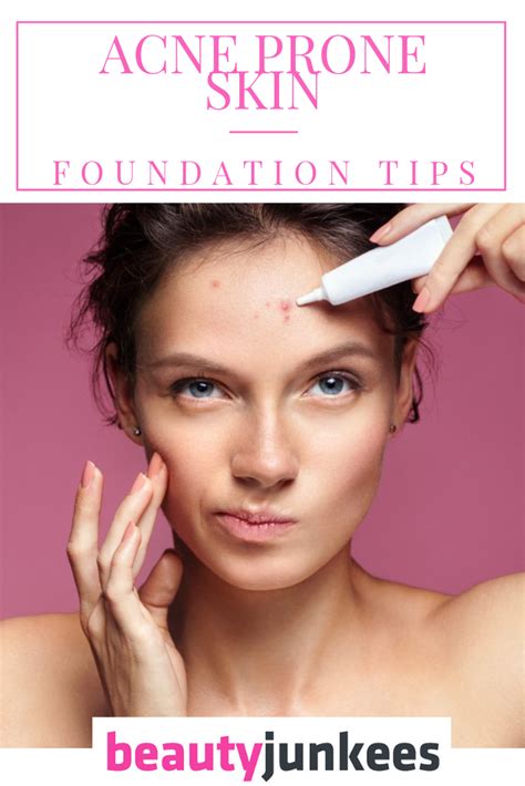 Foundation Tips For Acne Prone Skin Must Know Facts Foundation Acne