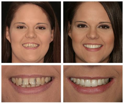 Digital Smile Design Smile Style Dental Bulleen